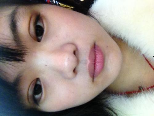 割双眼皮视频过程视频,从术前准备到术后恢复