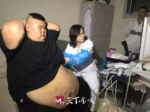 肥美人视频,揭秘健康塑形新潮流