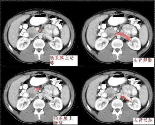 腹部解剖视频,深入解析人体核心区域